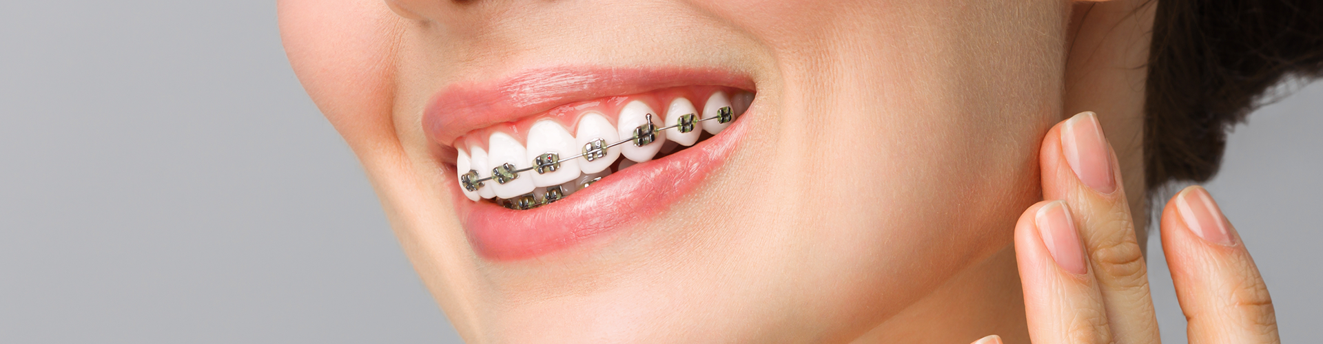 Woman with braces holding hand on her cheek.